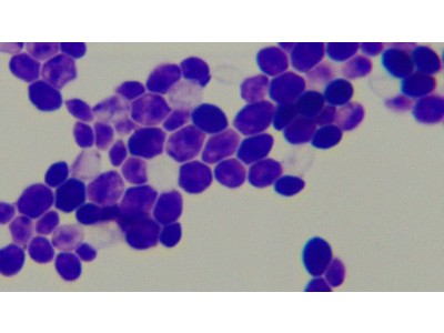 МІСТ ДРУЖБИ І НАУКИ: БОЛГАРСЬКІ ПАРТНЕРИ ПОДАРУВАЛИ КОЛЕДЖУ ЦИФРОВИЙ МІКРОСКОП